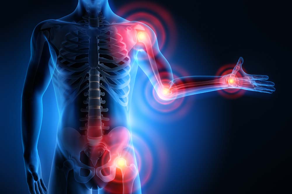 Fibromialgia: un forte aiuto dalla chetogenica